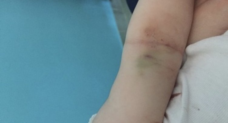 Incubo in ospedale: “Mia figlia in fin di vita e non c’era un ago per lei” - aSalerno.it